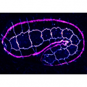 Quand les contractions musculaires déterminent la forme d’un ver